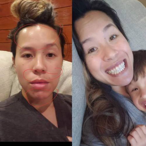 Skincare routine