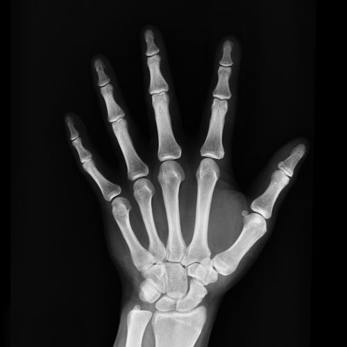 Orthopedic Nurse Practitioner resources